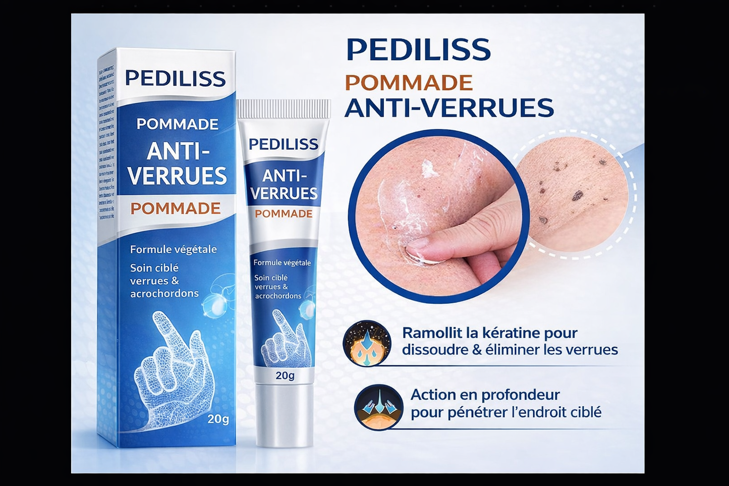 Crème ciblée : verrues, cors &  acrochordons