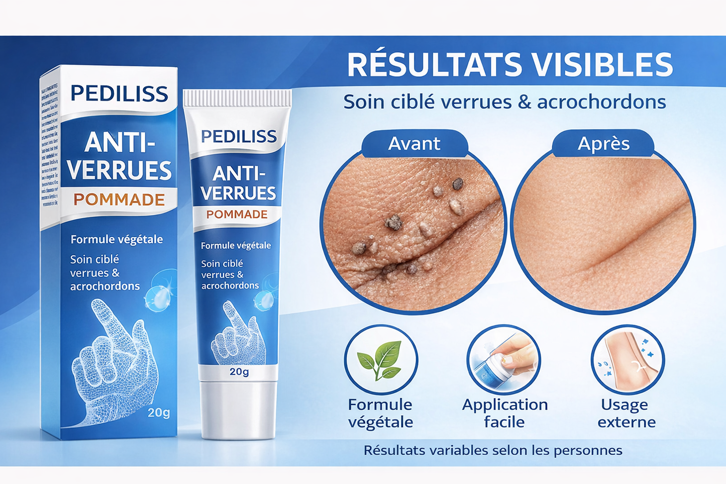 Crème ciblée : verrues, cors &  acrochordons
